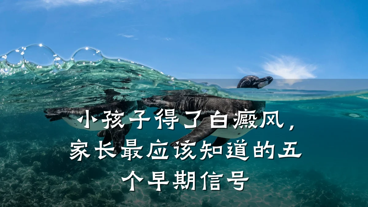 小孩子得了白癜风,家长最应该知道的五个早期信号